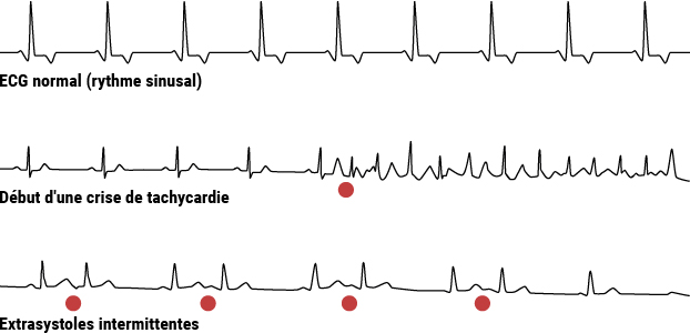 Schéma electrique coeur